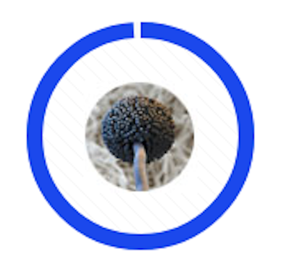 A microscopic view of a black, globe-shaped Aspergillus fungal spore head on a stalk, centered in a blue circular frame.