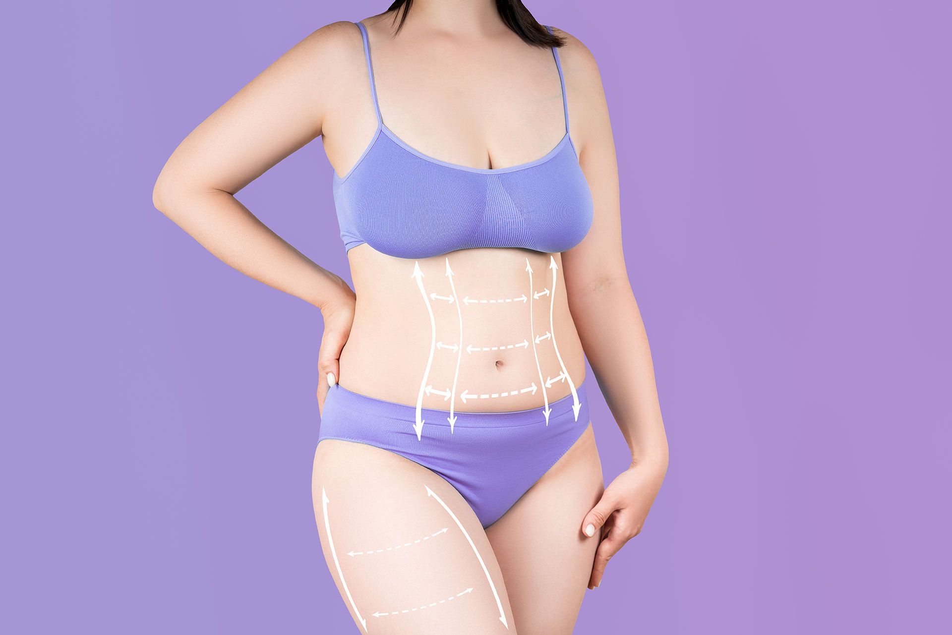 Abdomen and hips liposuction, fat and cellulite removal concept, overweight female body with painted surgical lines and arrows