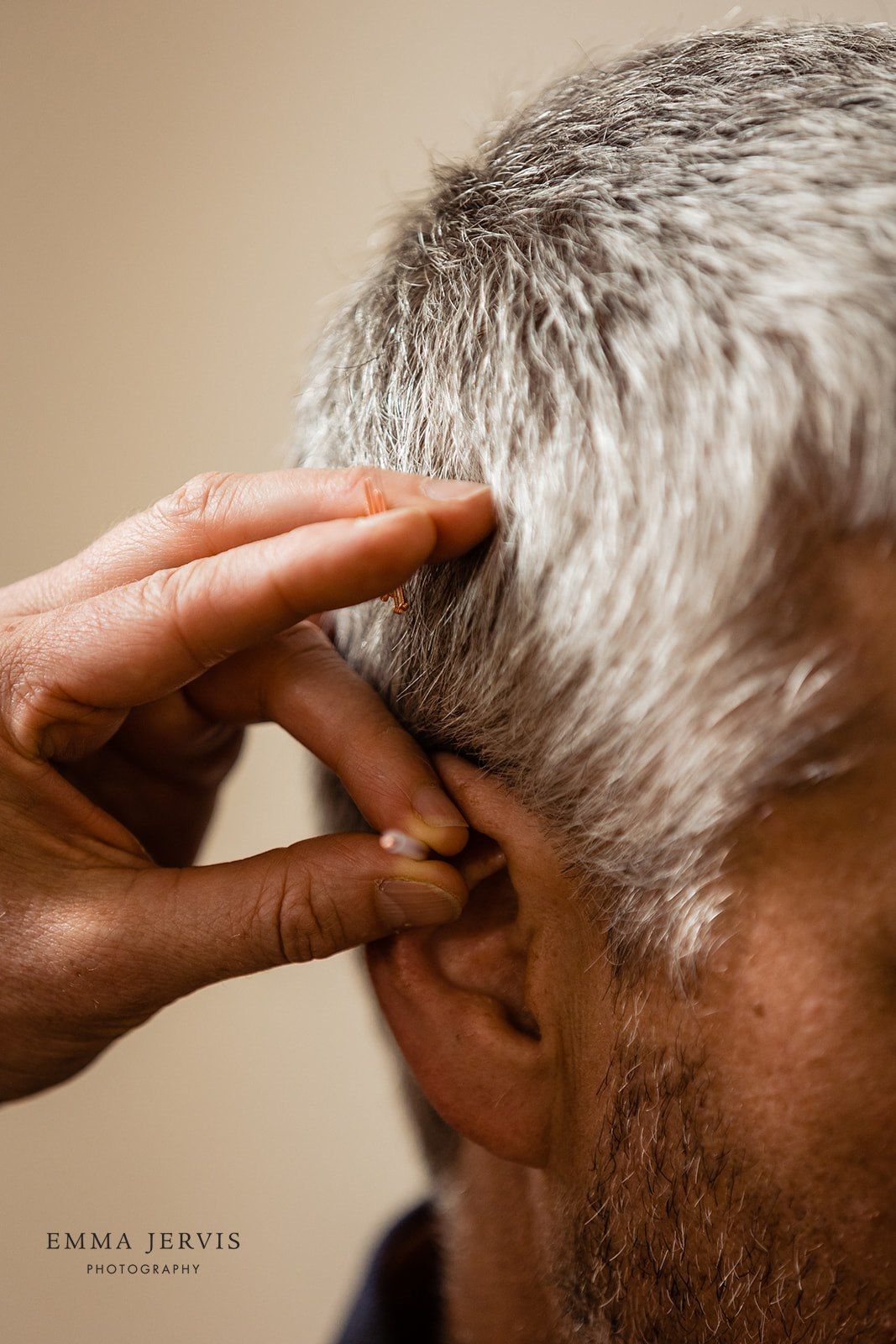 Acupuncture Practitioner during acupuncture session in West Cork