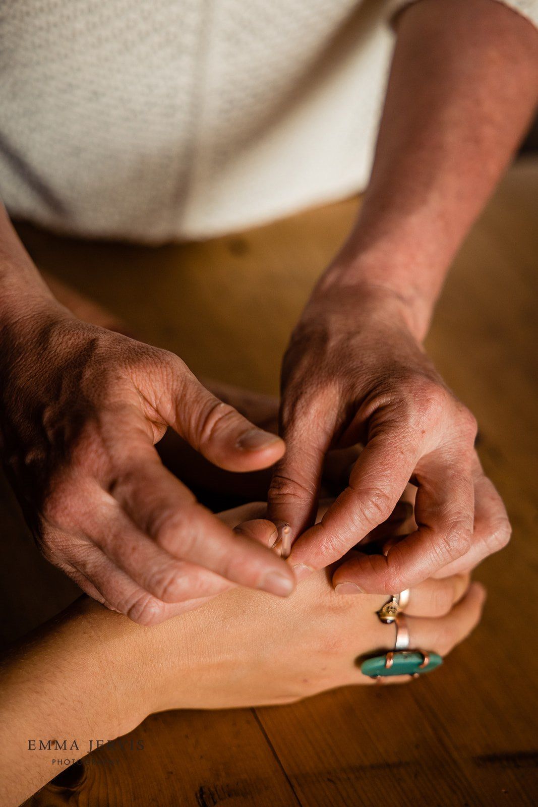 a man is giving a woman a acupuncture treatment on her wrist .