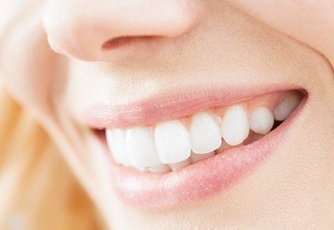 Teeth Whitening — Woman's Bright Teeth in Royal Oak, MI