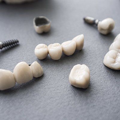 Dental Crowns — Dental Crowns in Royal Oak, MI