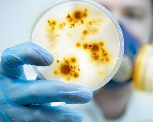 Disinfezione Virus, batteri e muffe