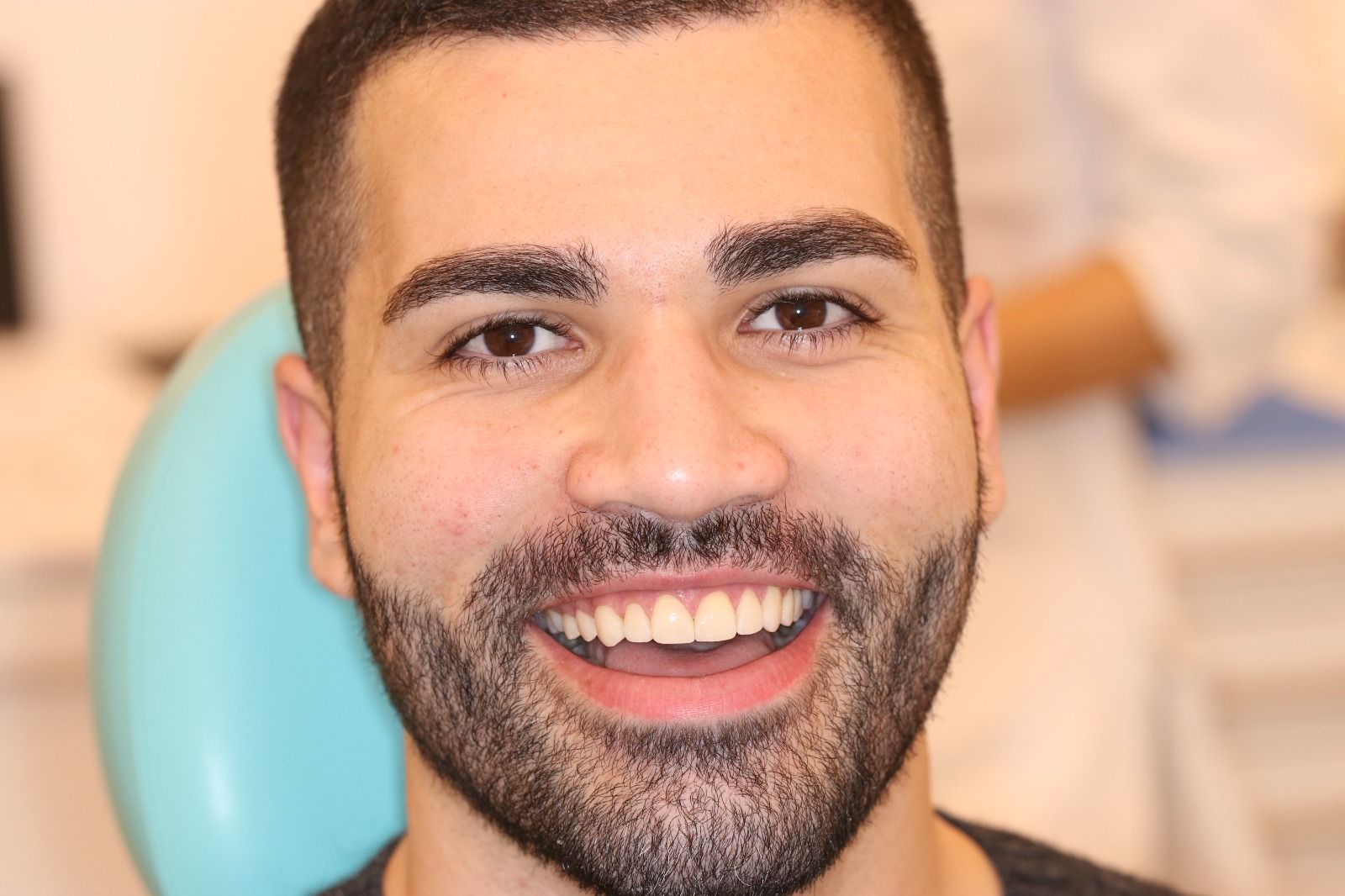 Daniele dopo le faccette