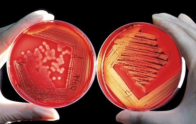 Bacteria growing on blood agar