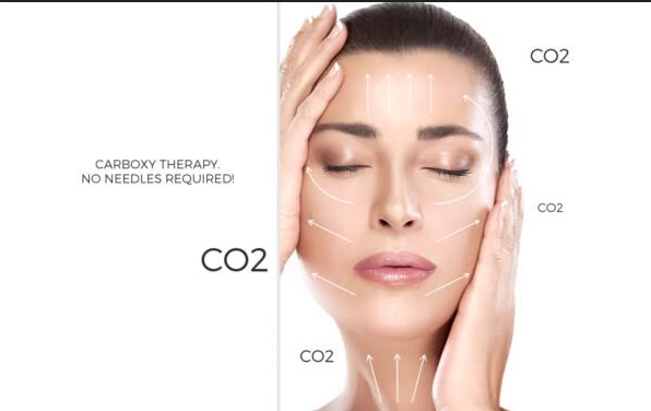 CO2 Carboxy Therapy