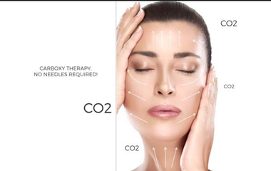 CO2 Carboxy Therapy