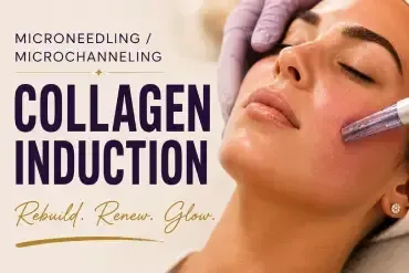  Collagen Induction Therapy