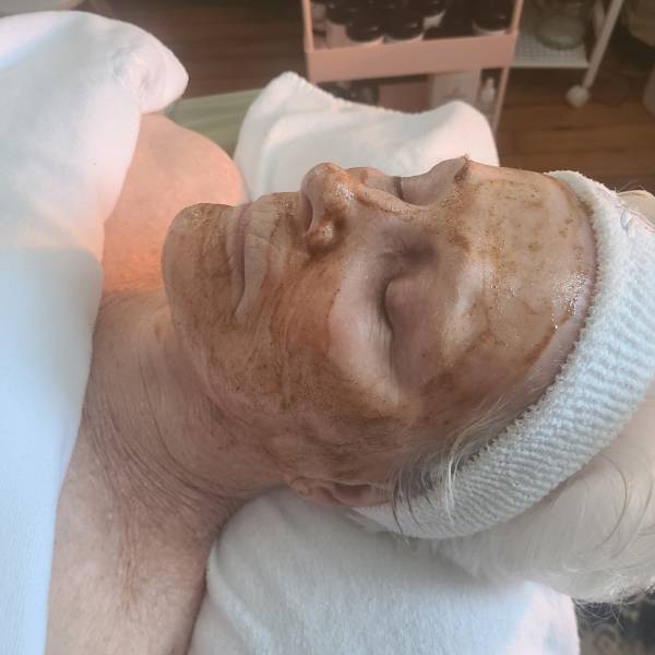 Facial Treatment Procedure