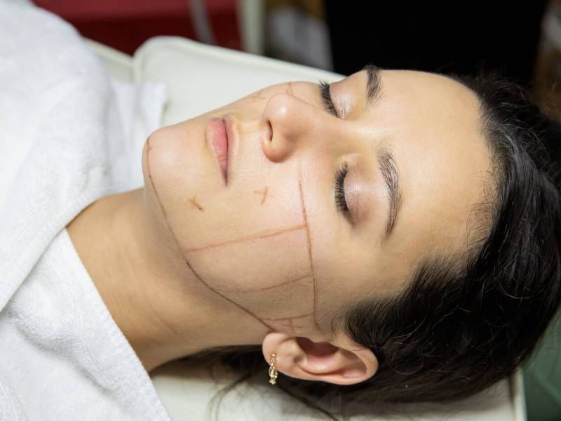 HIFU Treatment for Face