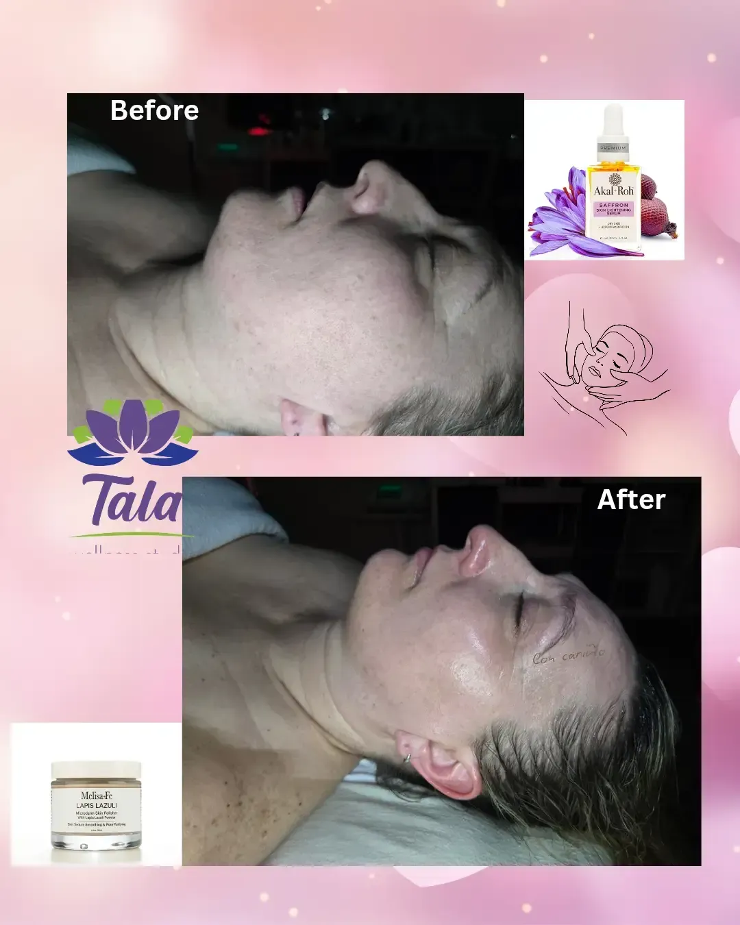 Before and after facial treatment results at Tala Wellness Studio in Summerville, SC showing smoother and more radiant skin.