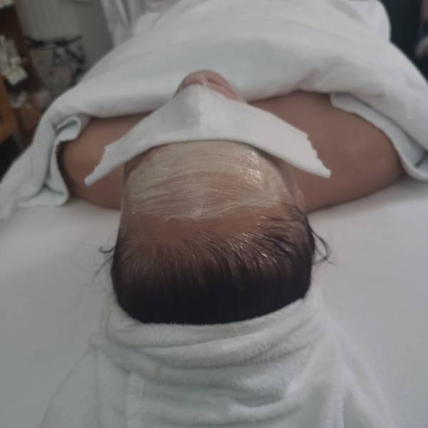 skin care treatment procedure