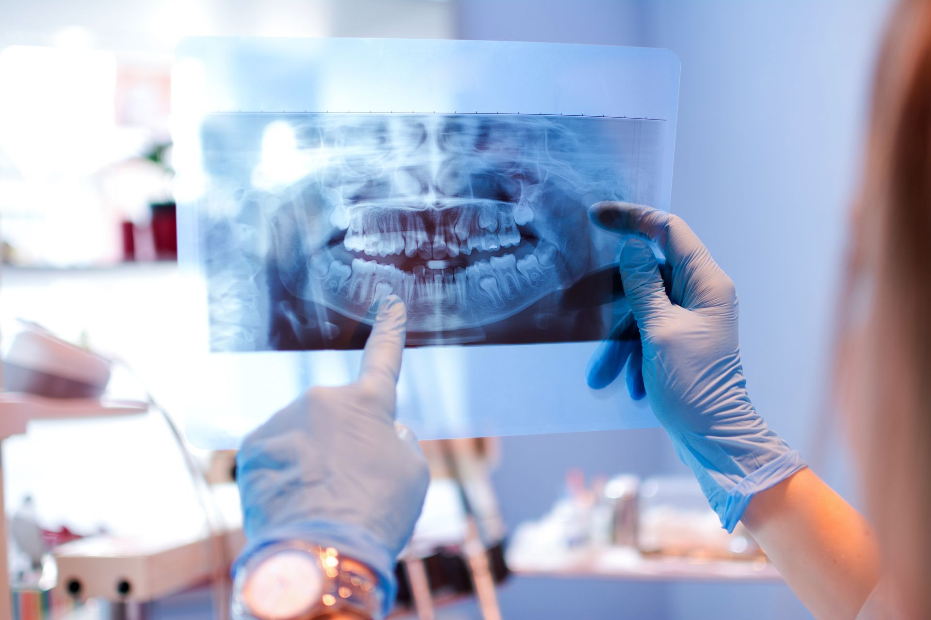 A professional in blue gloves points to a dental panoramic X-ray in a clinical setting.