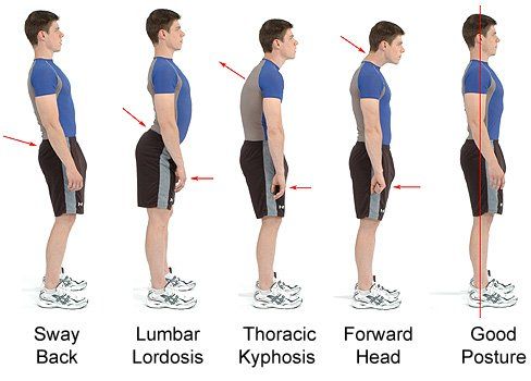 Human standing posture types and comparison photo illustration
