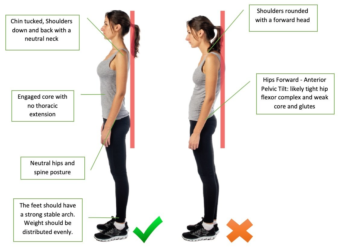 comparison of a healthy and a poor standing posture  of a female individual.