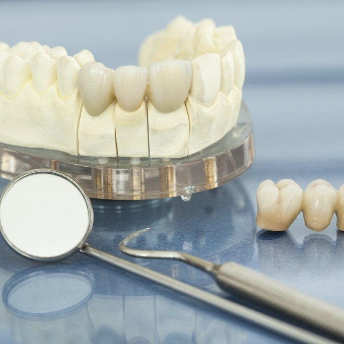 fake teeth and dental tools for crowns