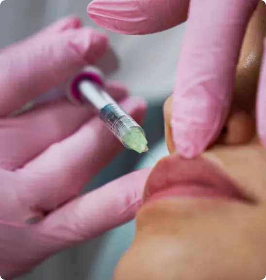 Person receiving lip filler injection, hands in pink gloves.