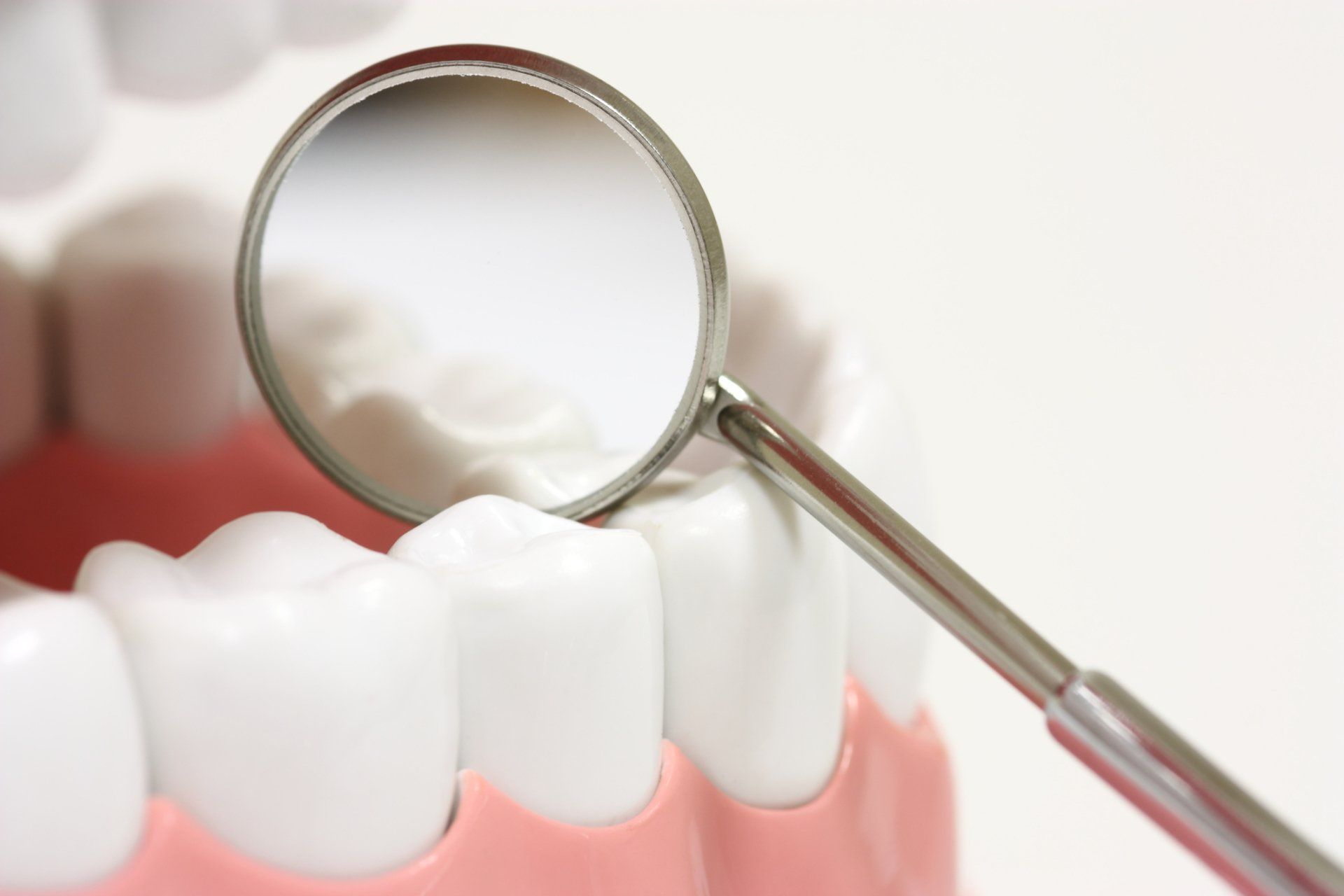 dental crowns