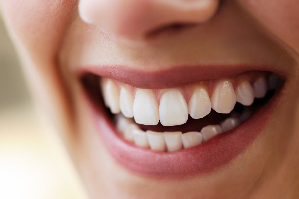 Cosmetic Dentistry, woman with white teeth smiling