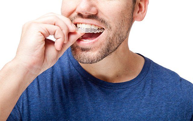 invisalign, Potomac Falls Family Dentistry