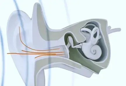 Hearing Loss Outer Ear