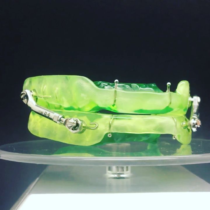 apparecchi per denti