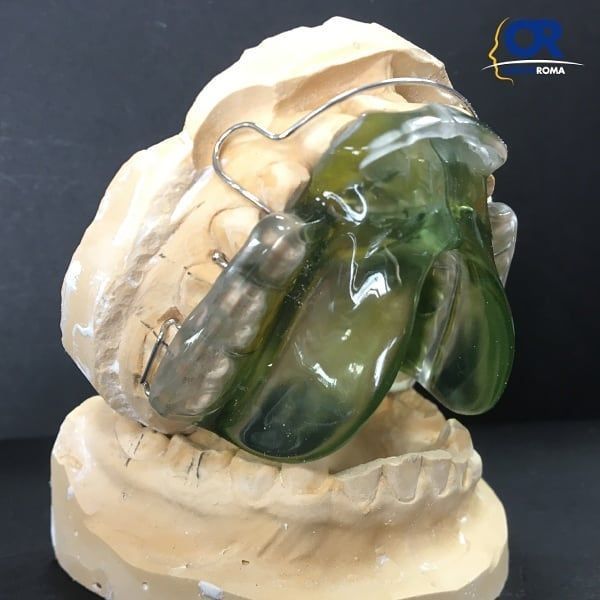 apparecchio di contenzione