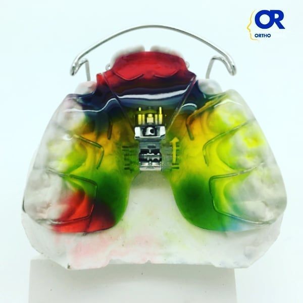 apparecchio di mobile contenzione