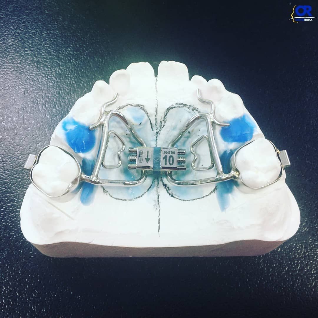 apparecchi ortodontici