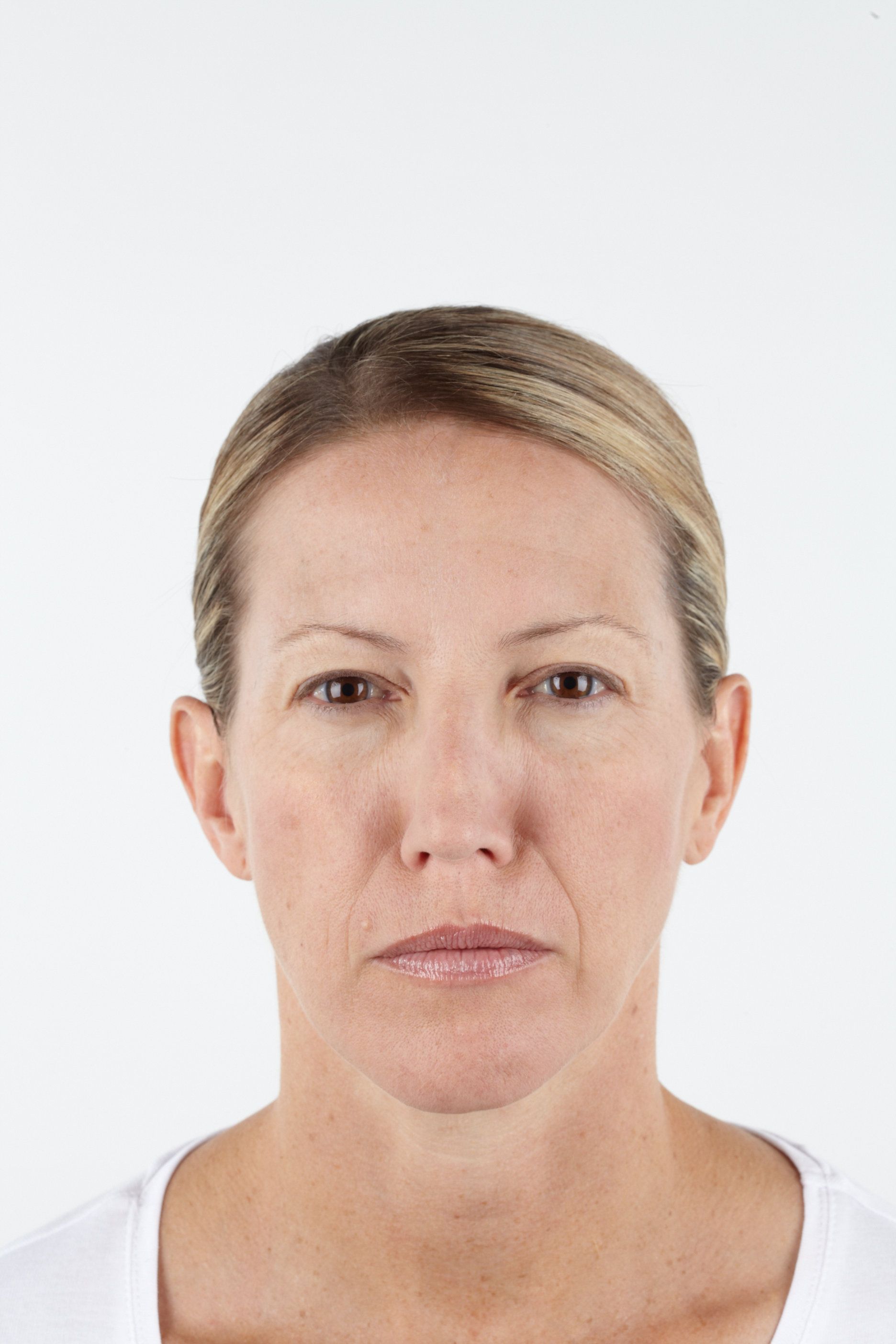 frown botox burlington modern you
Best Botox clinics Burlington
Affordable Botox treatments
Botox for forehead lines
Xeomin injections Burlington
Dysport for fine lines
Preventative Botox
Botox for facial contouring
How long does Botox last?
Botox side effects
Botox touch-up treatments
Dysport treatment benefits
Xeomin vs. Dysport
Botox for excessive sweating
Botox for neck bands
Smooth facial wrinkles
Injectable wrinkle treatments
Top-rated Botox provider
Non-surgical facial rejuvenation
Botox for smile lines
Customized Botox plans
