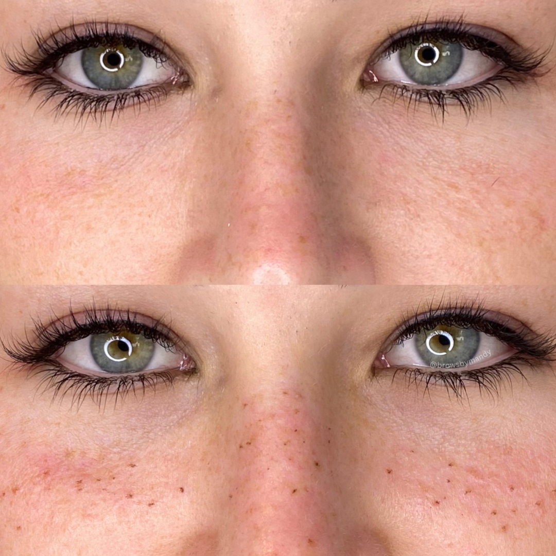 Comparison of two photos. Top photo shows a woman's face with lines. Bottom photo shows the same face with freckles.