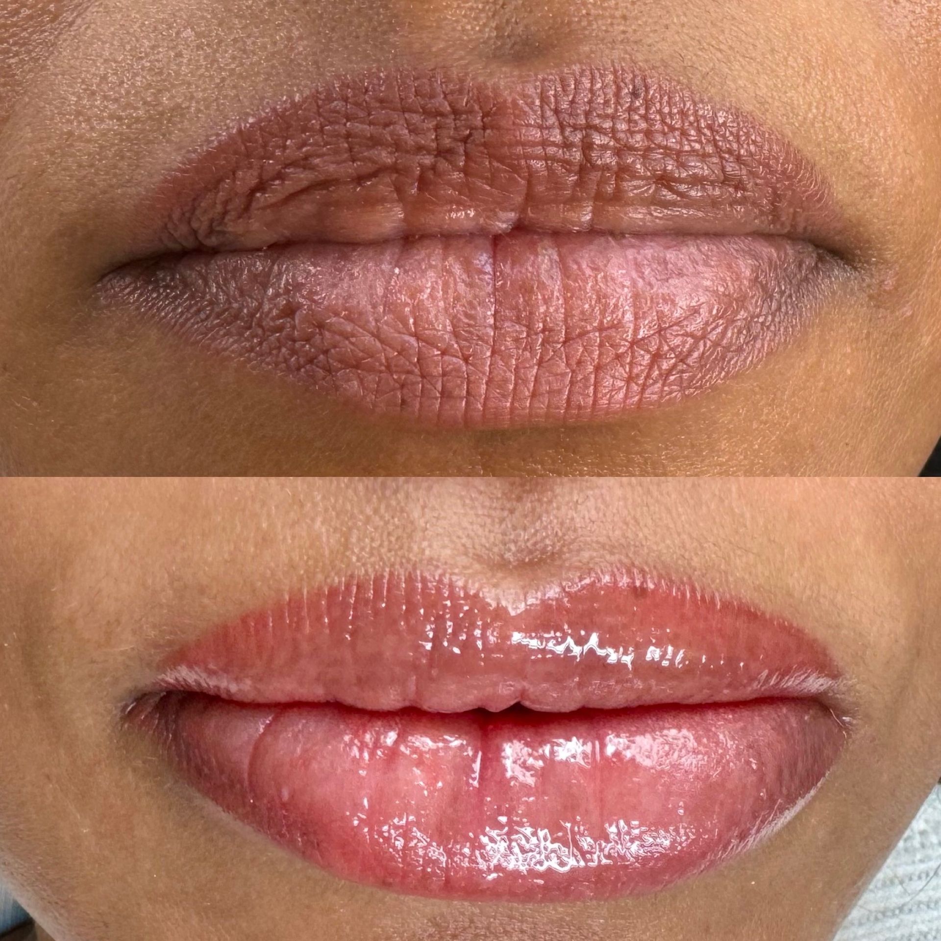Top: Before lip treatment. Bottom: After lip treatment. Lips appear fuller and pinker after.