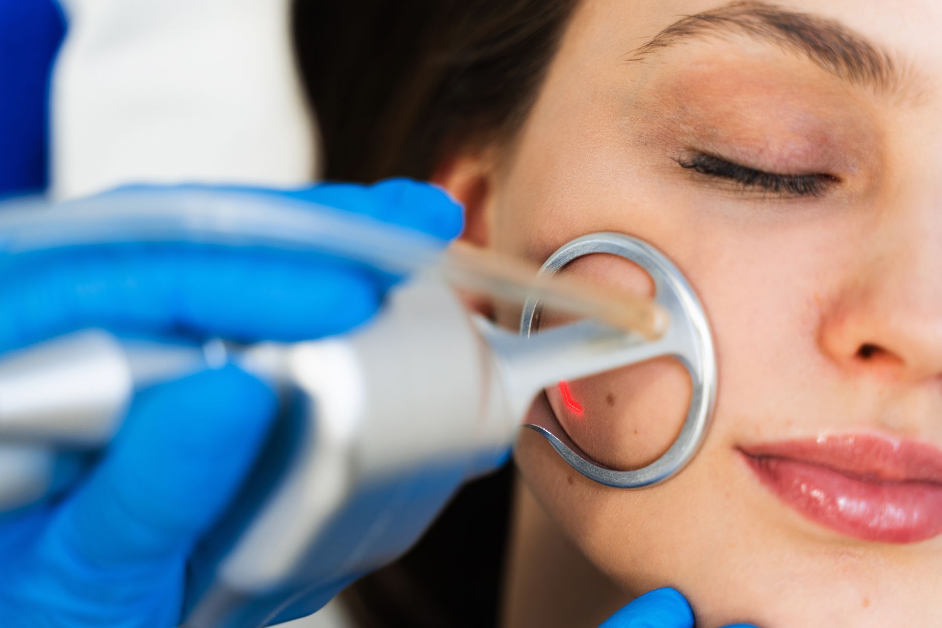 Woman receiving laser treatment on cheek from a gloved hand.