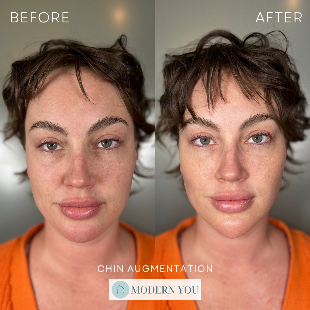 Side-by-side comparison of a woman's face. The