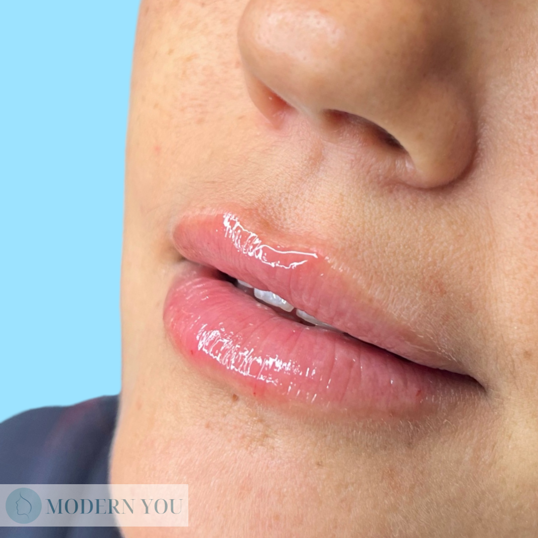 Close-up of a person's lips, which appear full, glossy, and slightly pink.