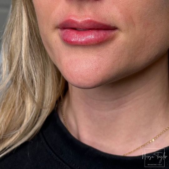 Close-up of woman's lips and chin; she has plump, pink lips, and is wearing a black shirt and gold necklace.