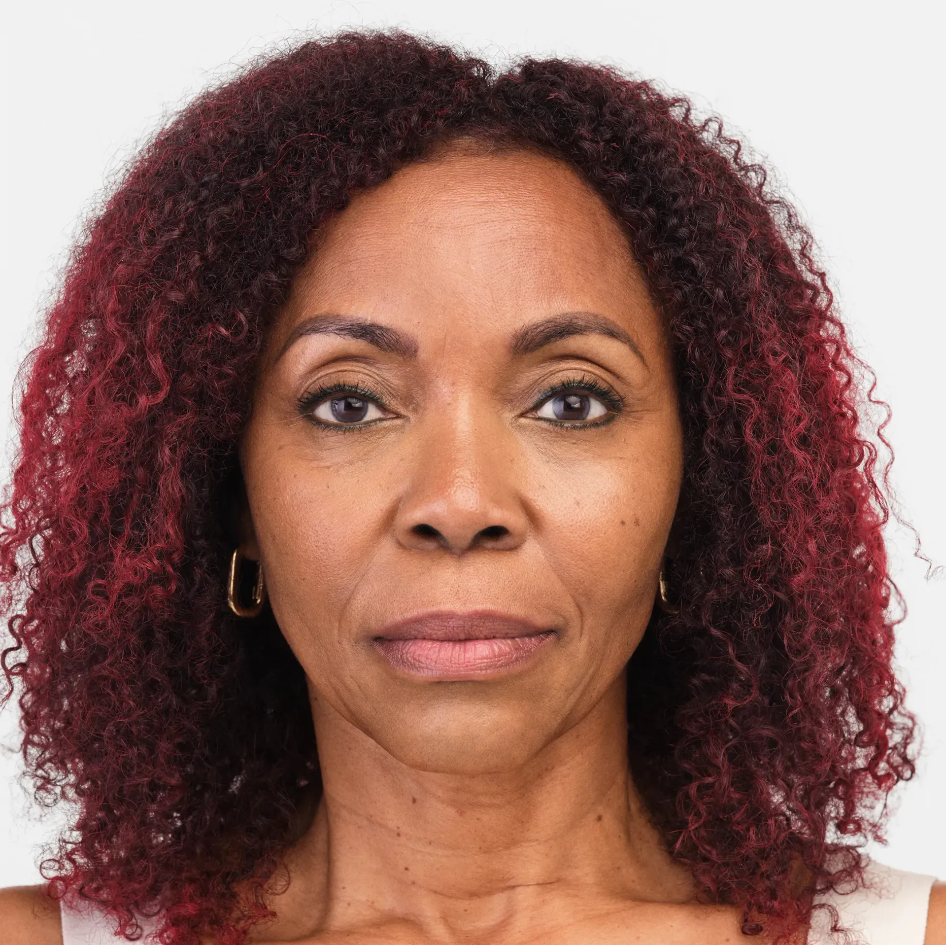 radiesse filler before and after burlington
Dermal fillers Burlington
Facial fillers
Lip fillers Burlington
Under-eye fillers
Cheek fillers
Non-surgical nose job
Filler for fine lines
Best fillers for volume
Hyaluronic acid fillers
Filler injections Burlington
Anti-aging fillers
Sculptra treatment Burlington
Natural-looking fillers
Filler for wrinkles
Liquid facelift Burlington
Collagen-stimulating fillers
Radiesse treatment
Filler consultation Burlington
Non-invasive facial treatments
Aesthetic filler services