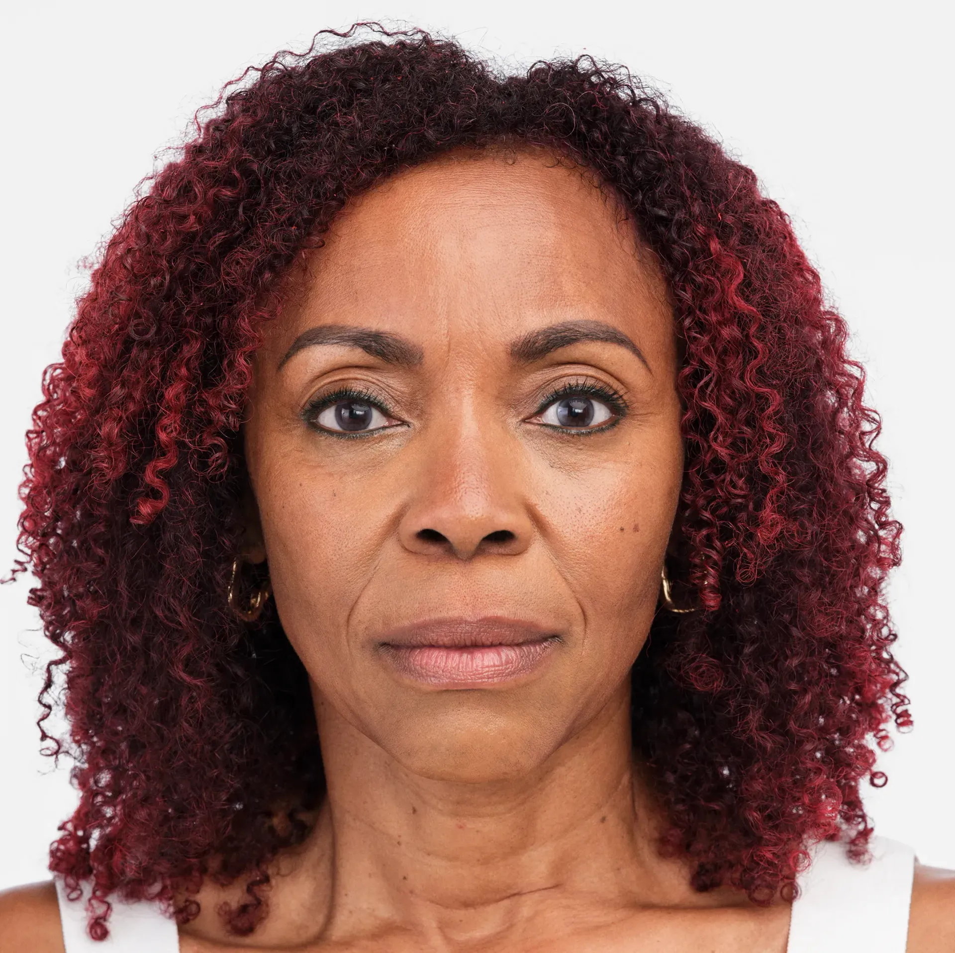 filler medispa
Dermal fillers Burlington
Facial fillers
Lip fillers Burlington
Under-eye fillers
Cheek fillers
Non-surgical nose job
Filler for fine lines
Best fillers for volume
Hyaluronic acid fillers
Filler injections Burlington
Anti-aging fillers
Sculptra treatment Burlington
Natural-looking fillers
Filler for wrinkles
Liquid facelift Burlington
Collagen-stimulating fillers
Radiesse treatment
Filler consultation Burlington
Non-invasive facial treatments
Aesthetic filler services