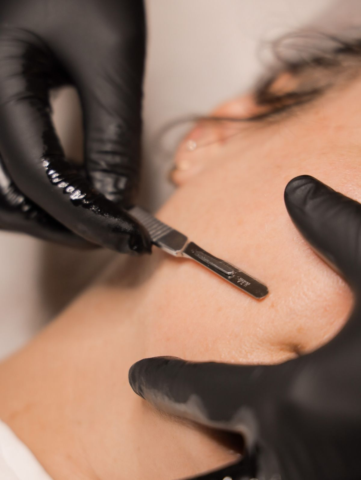 Dermaplaning in burlington, peach fuzz shaving