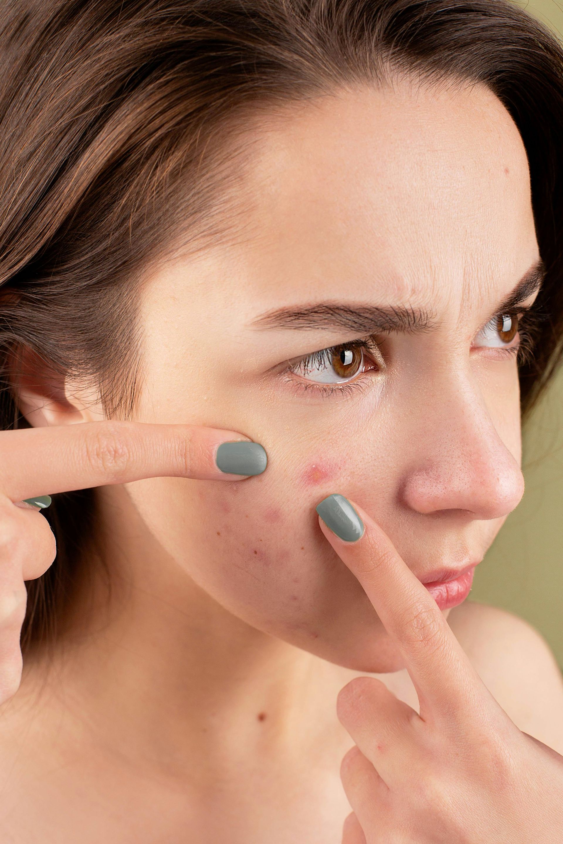 A person looking in a mirror and using their fingers to squeeze a pimple on their cheek.