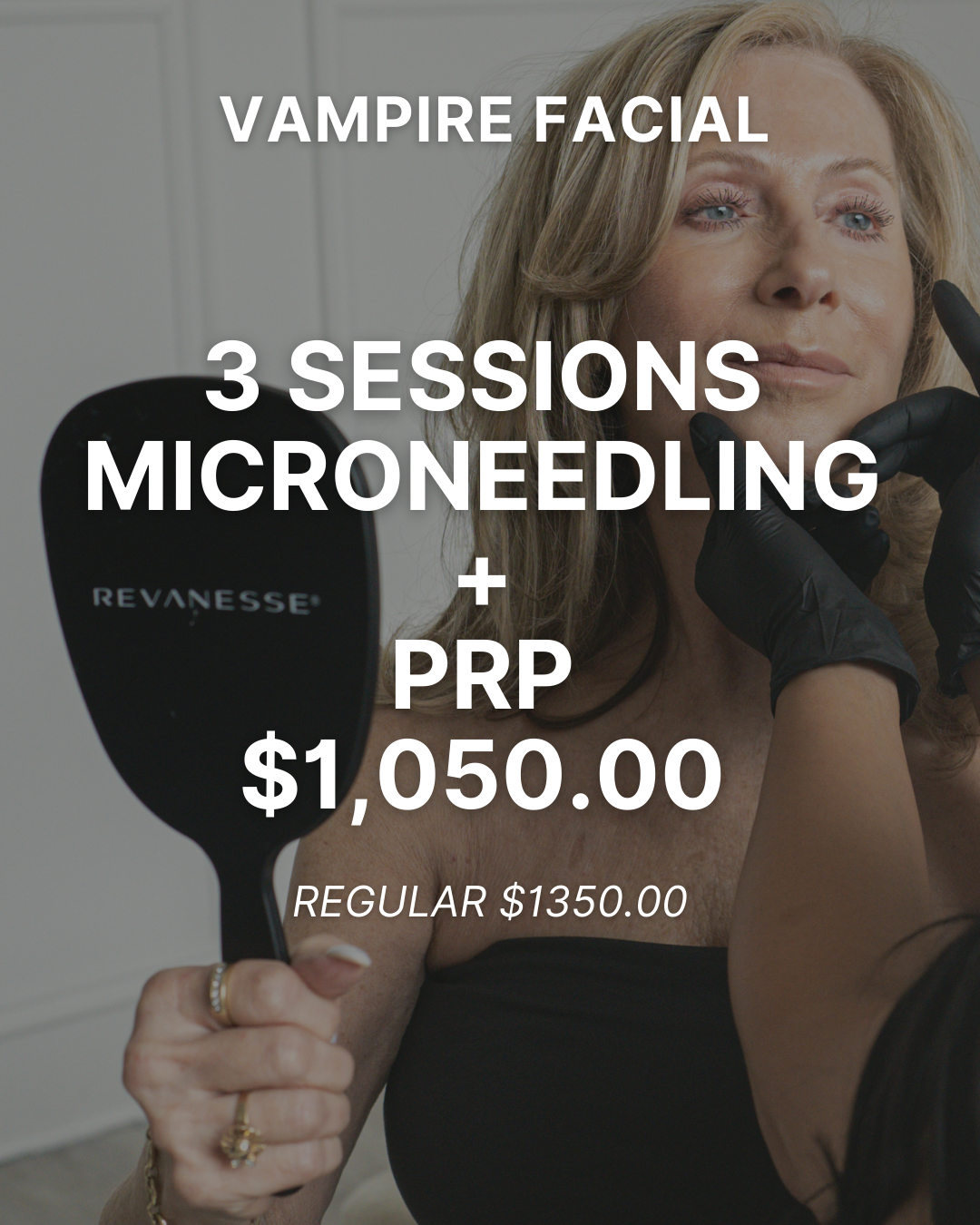 vampire facial special, microneedling and prp facial promo burlington