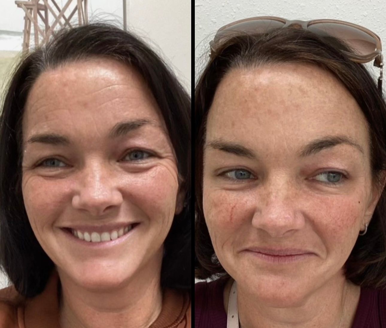 A before and after photo of a woman 's face