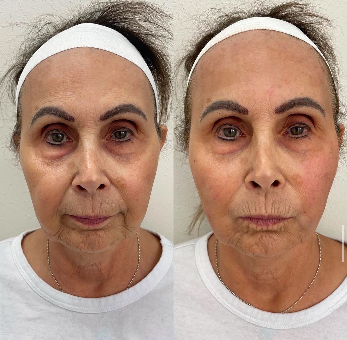 A before and after photo of a woman 's face