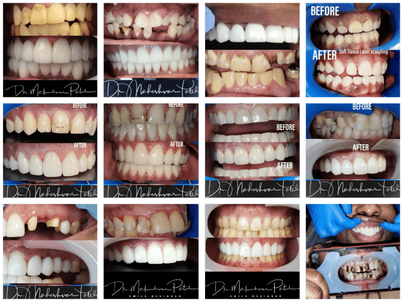 Before and Afters