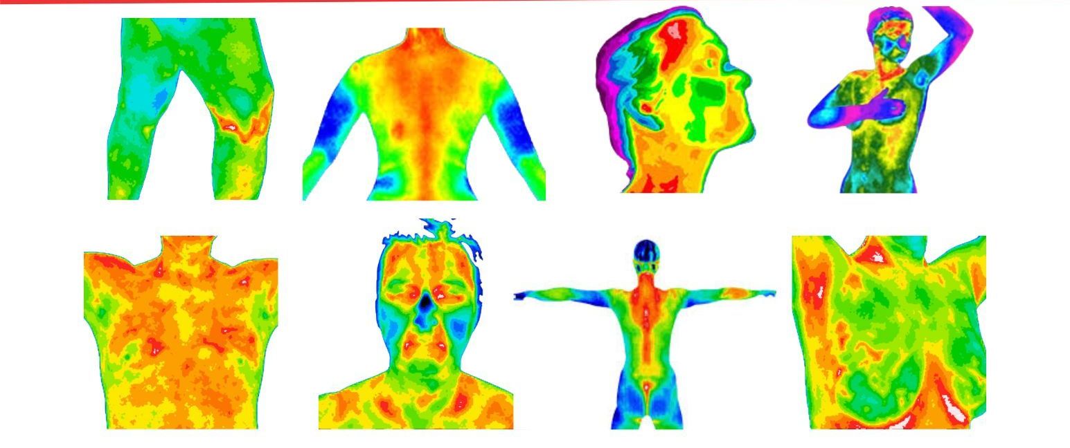 Thermography