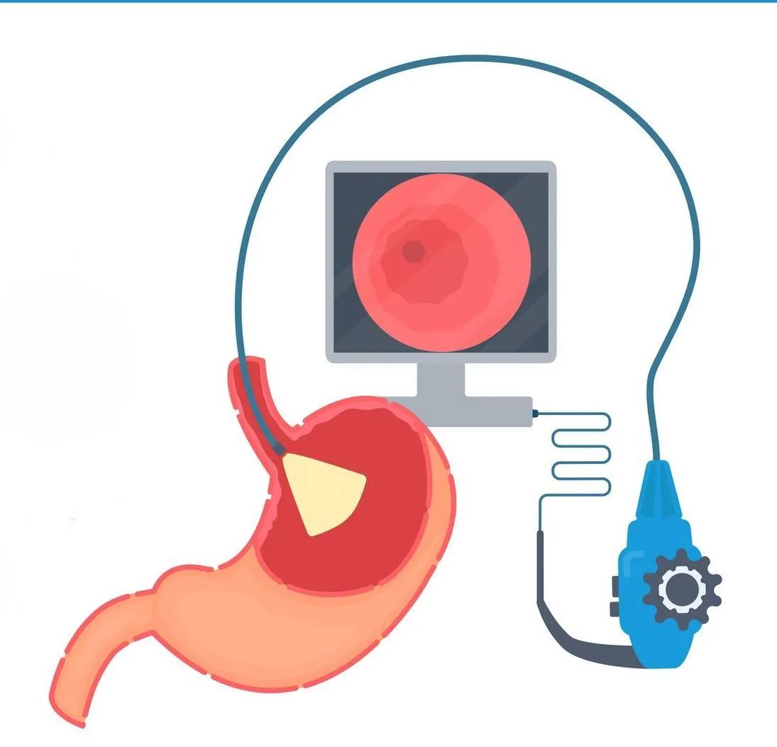 Gastroscopia dr Sferrazza Agrigento e Palermo