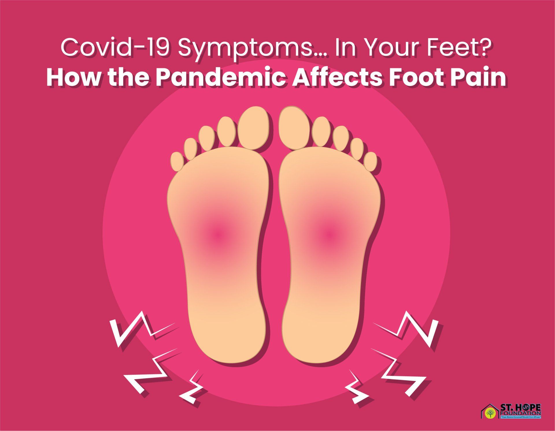 symptoms of Covid-19 in your feet