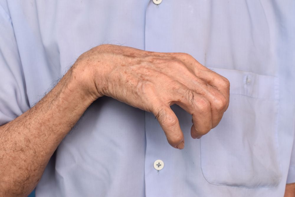 A man in a blue shirt showing his hand