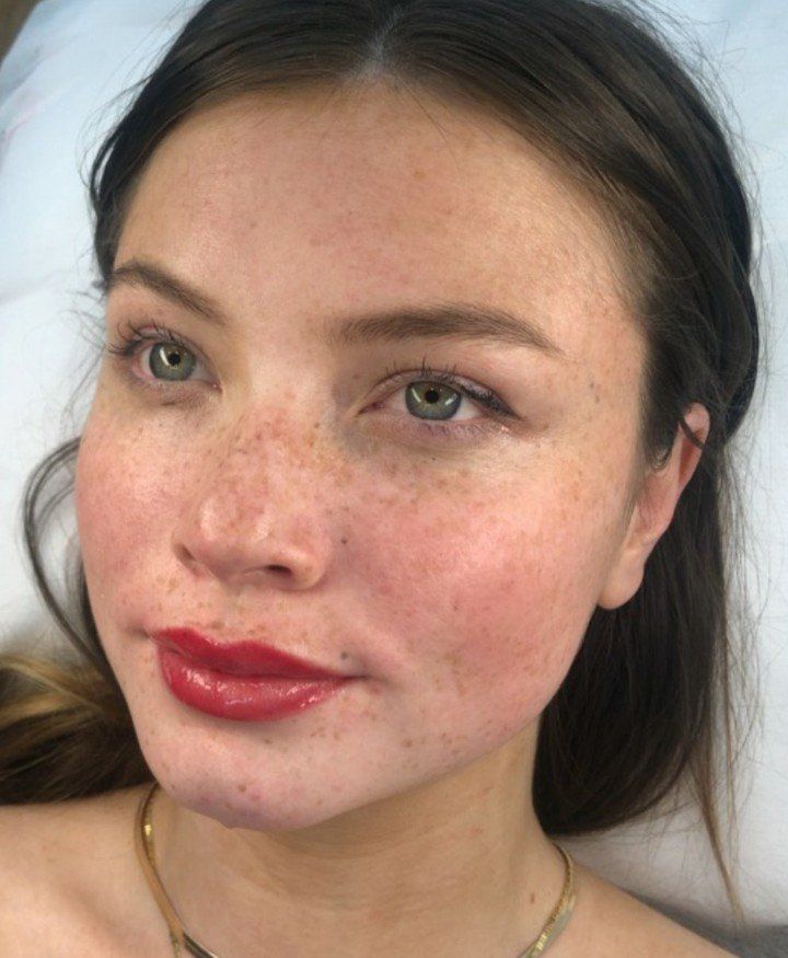 Cosmetic Lip Tattooing  - Artisan Cosmetic Tattoo & Beauty, Burleigh Heads, QLD