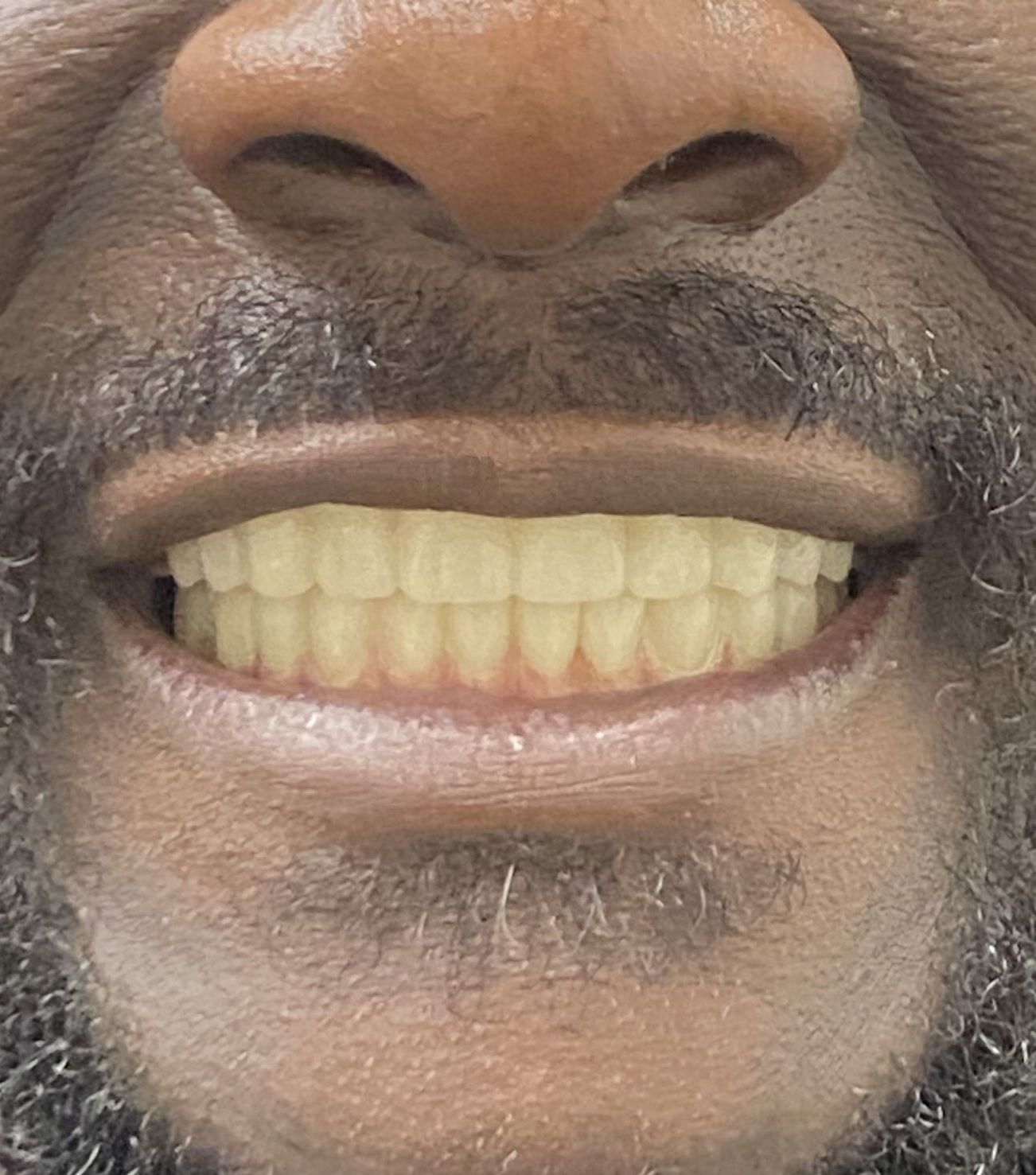 A close up of a man 's mouth with a beard and yellow teeth.